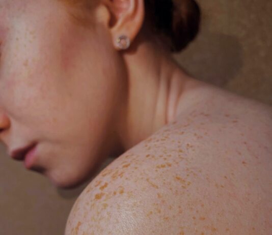 여름철 피부 건강, 올바른 관리법으로 지키세요 topless woman with brown hair